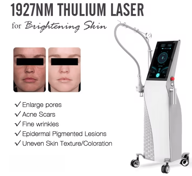 Professional 1927nm Thulium Fractional Laser for Pigmentation, Skin Whitening, Spot Removal & Rejuvenation