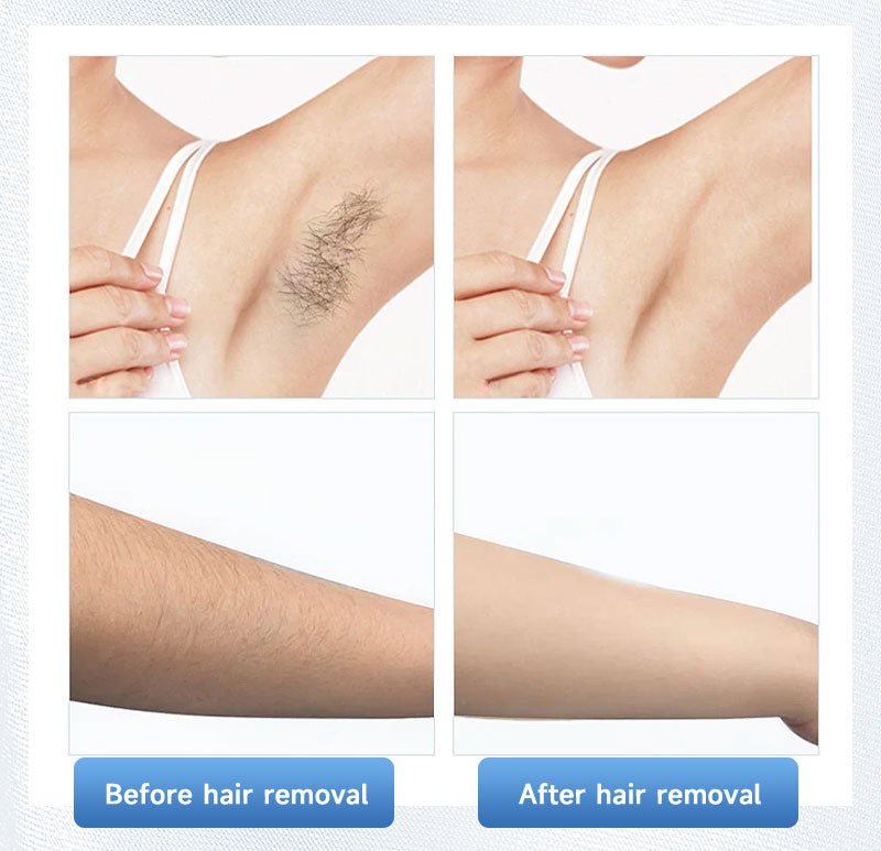 USA Laser bar 800W LT HPL KR Hair Removal Laser 800W 808nm Diode Bars Stack for Hair Removal Hand Piece Repair and Replacement